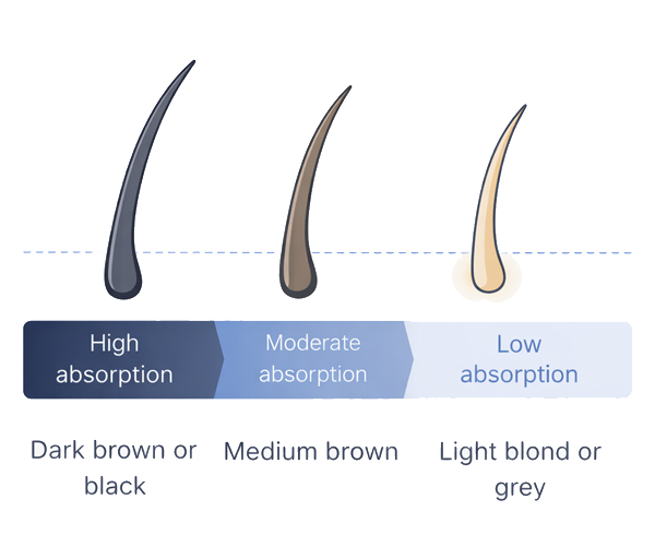 Line illustration showing how different hair colours affect IPL light absorption