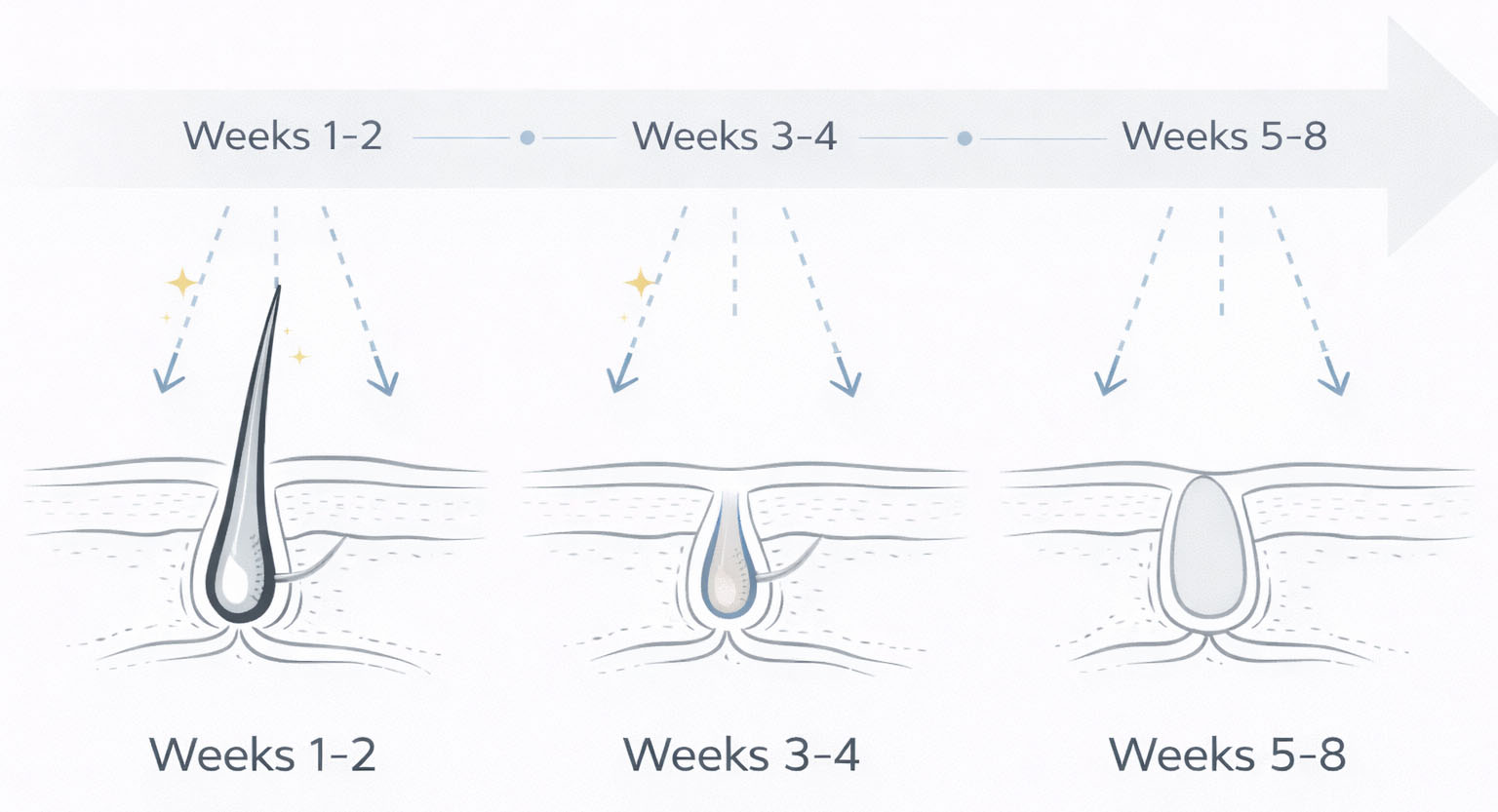 Timeline diagram showing gradual changes over weeks 1–2, 3–4, and 5–8 with consistent IPL sessions