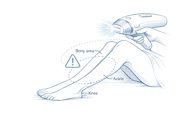 Minimal line illustration showing leg IPL safety boundaries and controlled spacing around knees and ankles