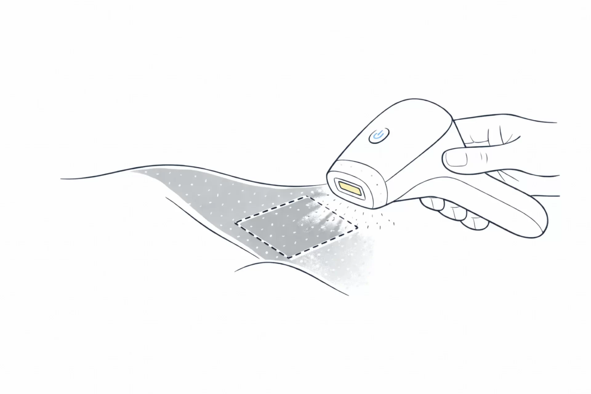 Illustration showing that a darker section of skin should be patch tested separately before IPL instead of treating the whole area the same way.
