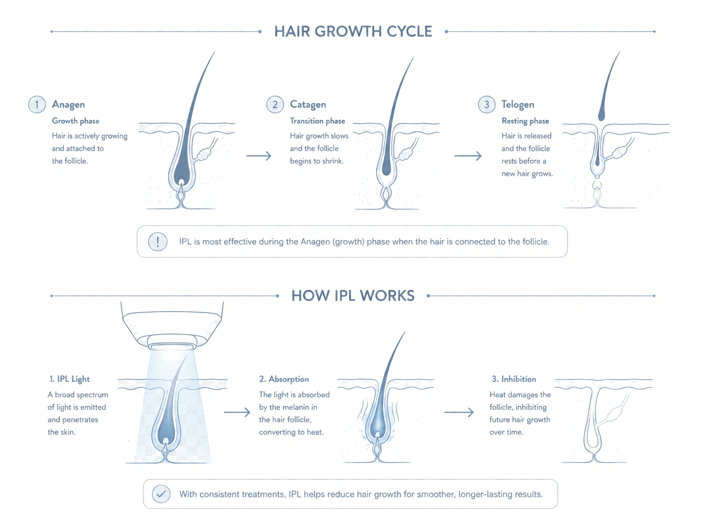 How IPL works with hair growth cycle and hair follicle