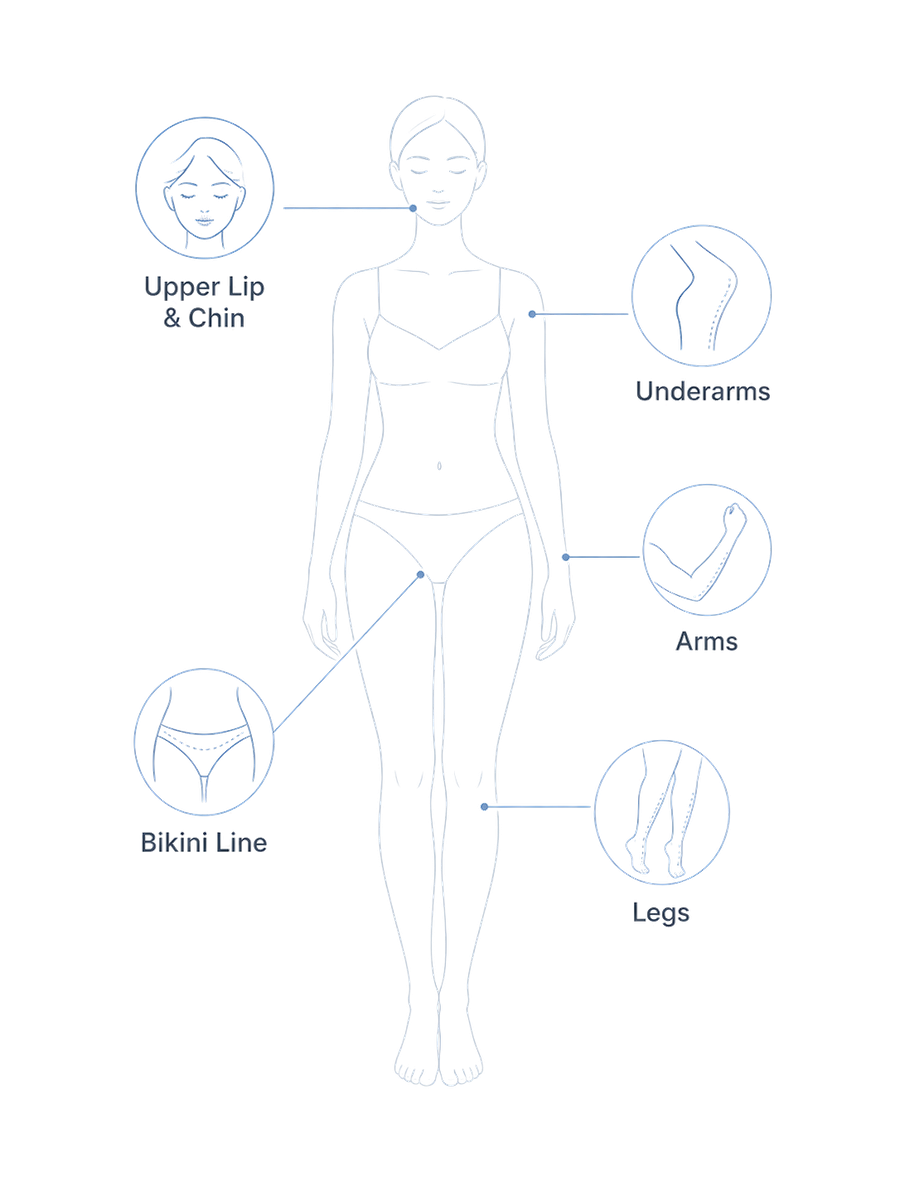 Illustration showing IPL treatment areas including the upper lip, chin, underarms, arms, bikini line and legs