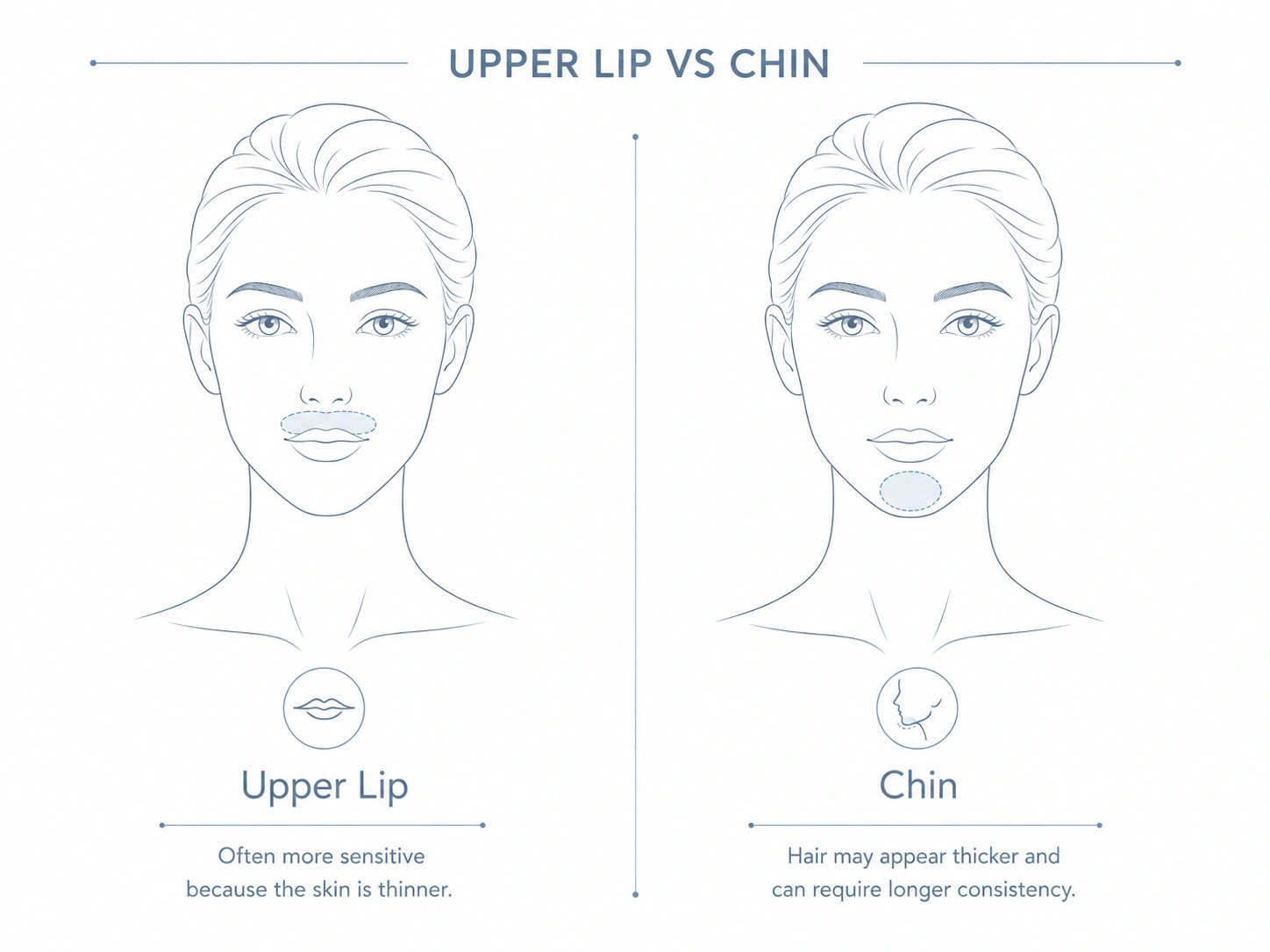 Upper lip vs chin IPL hair removal treatment areas
