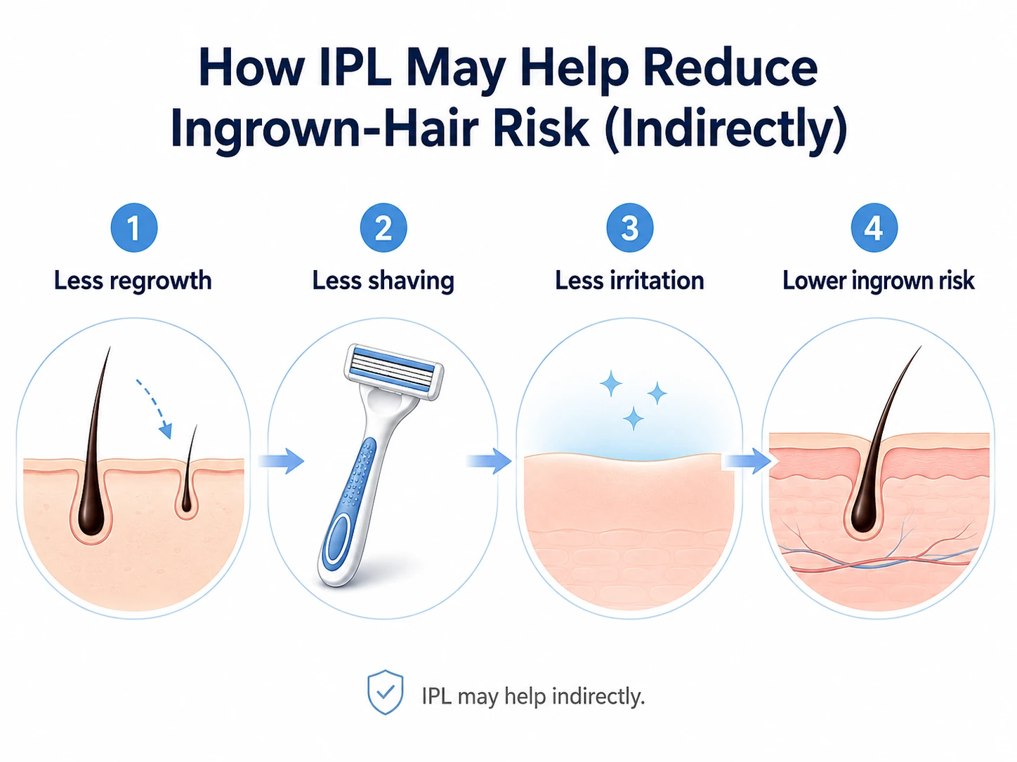 How IPL may reduce ingrown hair risk by reducing hair regrowth shaving frequency and irritation