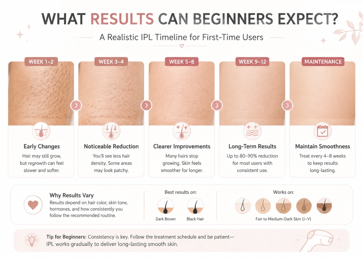 Realistic IPL results timeline for beginners showing gradual changes from the first weeks through longer-term maintenance