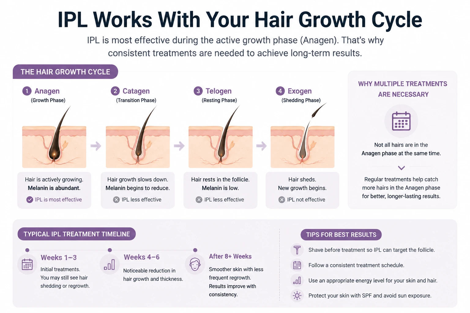 IPL hair removal hair growth cycle infographic showing anagen catagen and telogen phases